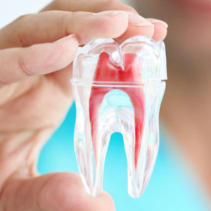Root Canal Treatment: A Tooth-Saving Option