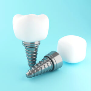 The latest developments in implant technology